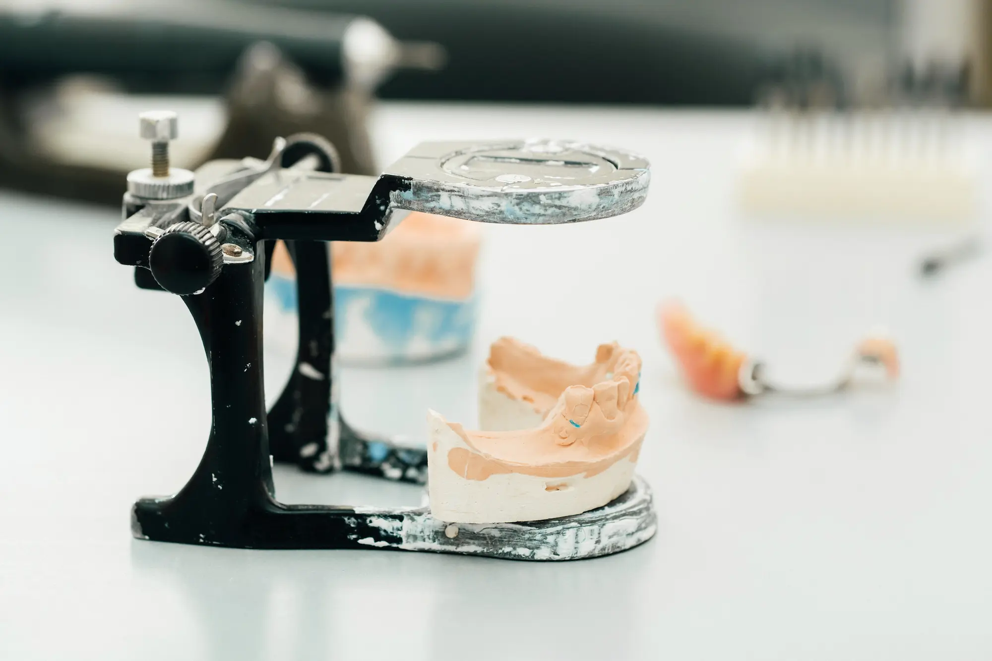 Articulator készülék gipszmintával