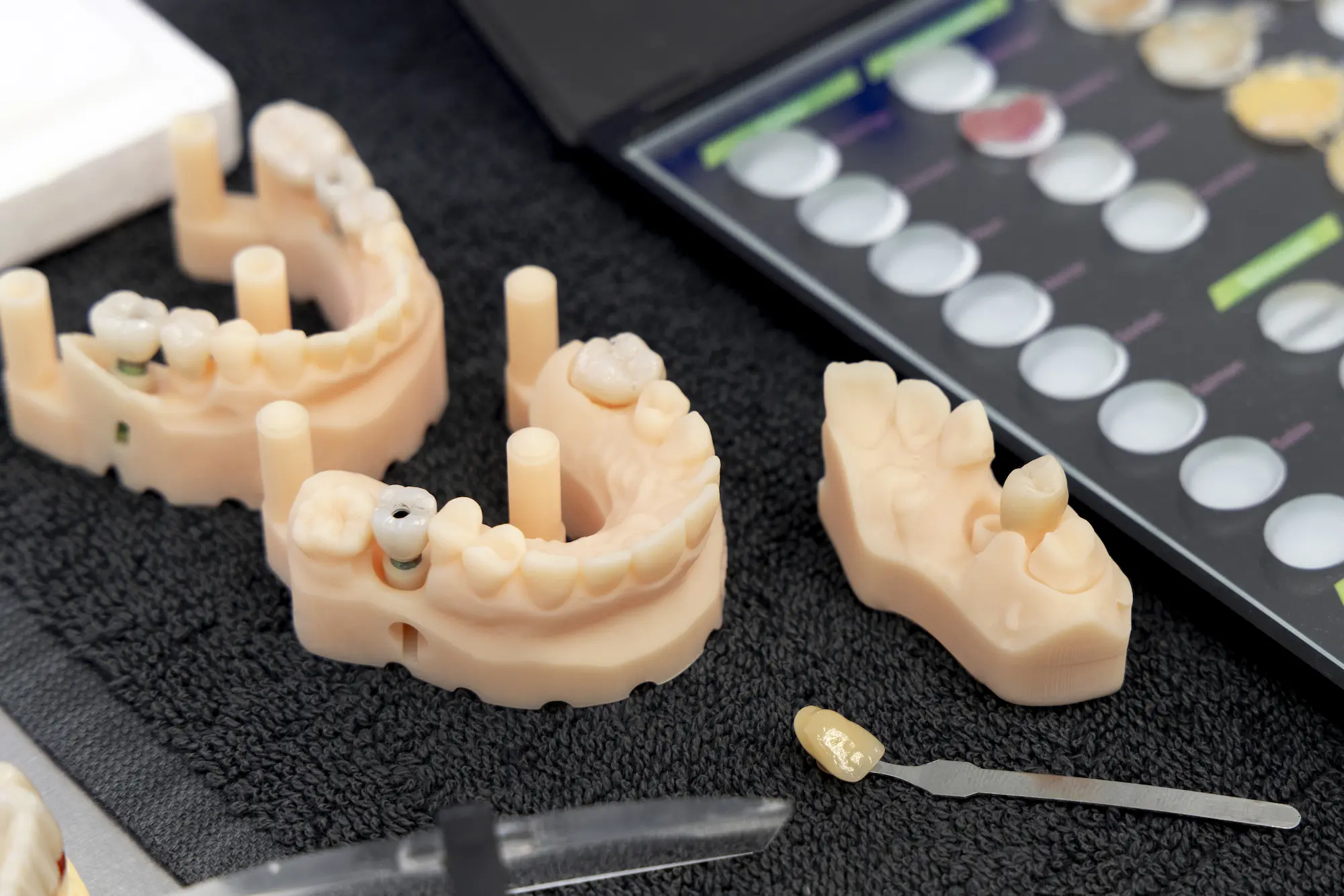 3D nyomtatott implantátum munkák